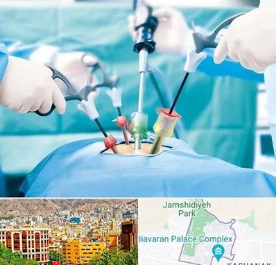 دکتر لاپاراسکوپی در نیاوران