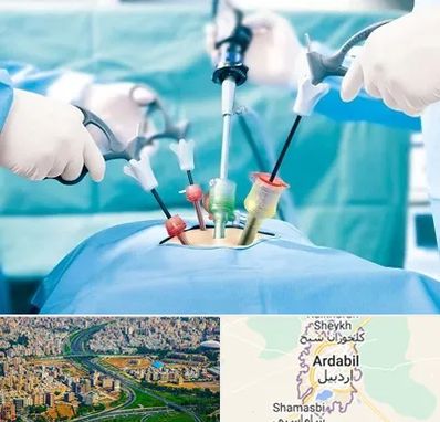 دکتر لاپاراسکوپی در اردبیل