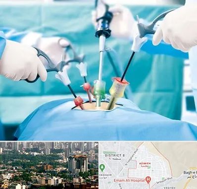 دکتر لاپاراسکوپی در عظیمیه کرج