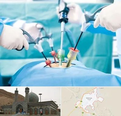 دکتر لاپاراسکوپی در شهرضا