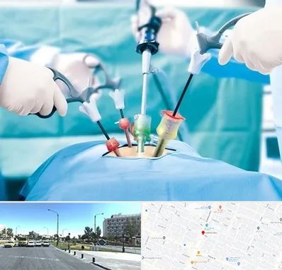 دکتر لاپاراسکوپی در بلوار کلاهدوز مشهد