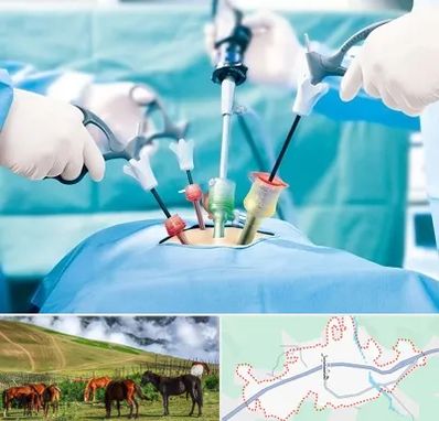 دکتر لاپاراسکوپی در تالش