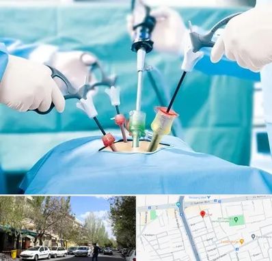 دکتر لاپاراسکوپی در کوی فیروز تبریز