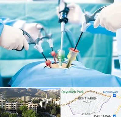 دکتر لاپاراسکوپی در اختیاریه