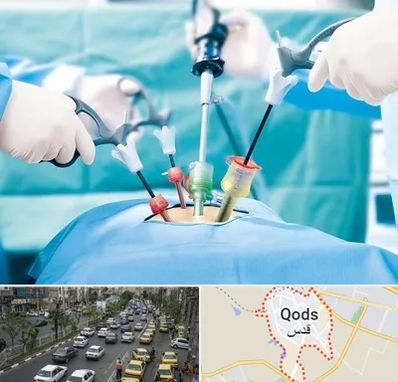 دکتر لاپاراسکوپی در شهر قدس