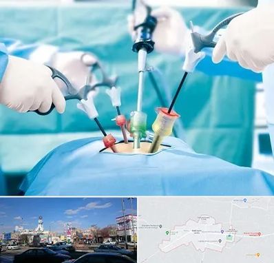 دکتر لاپاراسکوپی در ماهدشت کرج