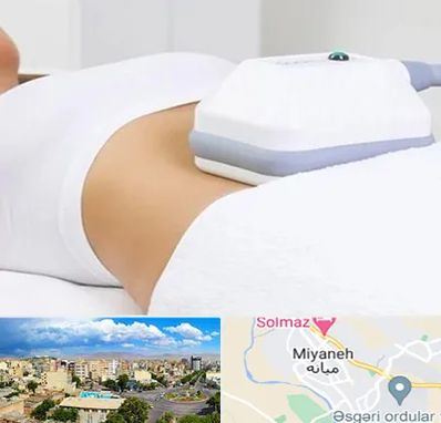 لاغری موضعی در میانه