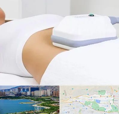 لاغری موضعی در منطقه 22 تهران 