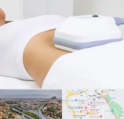 لاغری موضعی در معالی آباد شیراز 