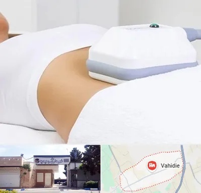 لاغری موضعی در وحیدیه شهریار