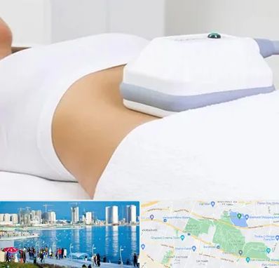 لاغری موضعی در چیتگر 