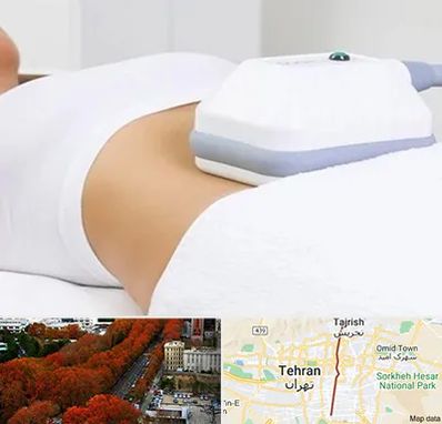 لاغری موضعی در ولیعصر 