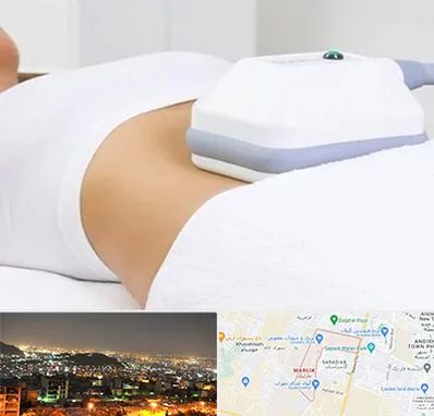 لاغری موضعی در مارلیک کرج 