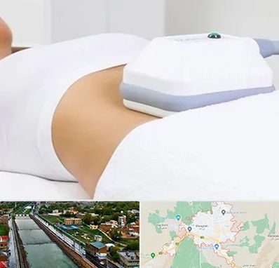 لاغری موضعی در مراغه