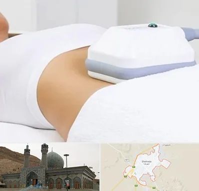 لاغری موضعی در شهرضا