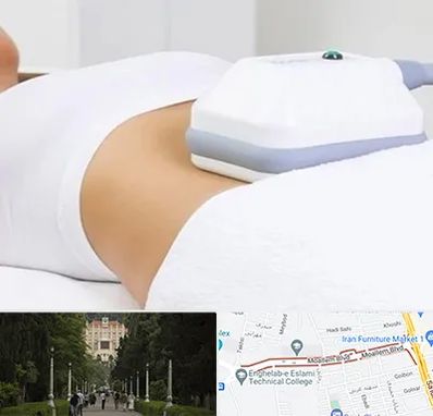 لاغری موضعی در بلوار معلم رشت 