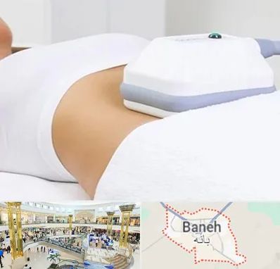 لاغری موضعی در بانه