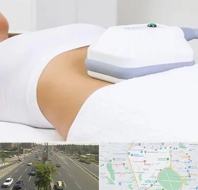 لاغری موضعی در منطقه 17 تهران 