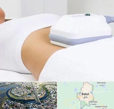 لاغری موضعی در بابل