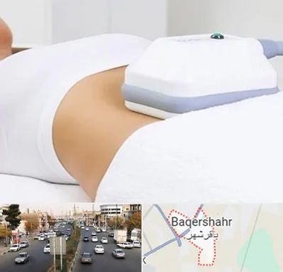 لاغری موضعی در باقرشهر