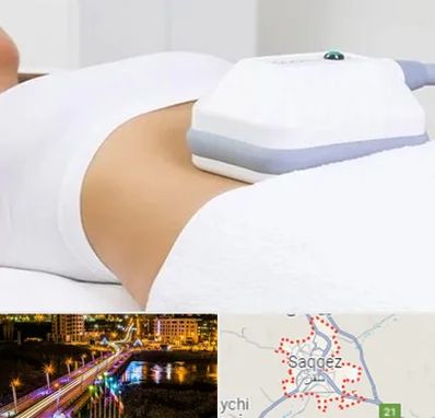 لاغری موضعی در سقز