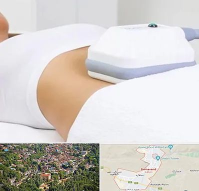 لاغری موضعی در دماوند