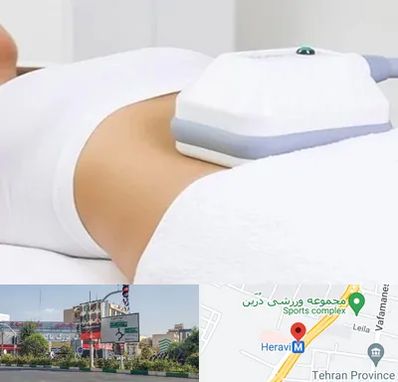 لاغری موضعی در هروی 