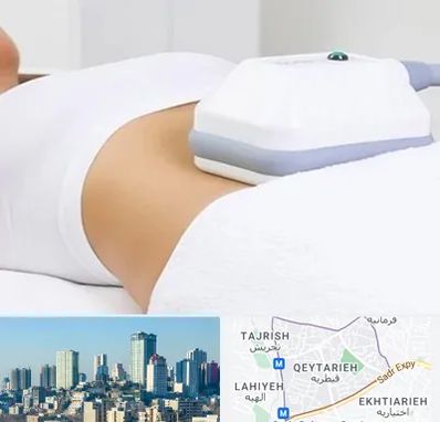 لاغری موضعی در قیطریه 