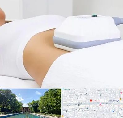 لاغری موضعی در هشت بهشت اصفهان 