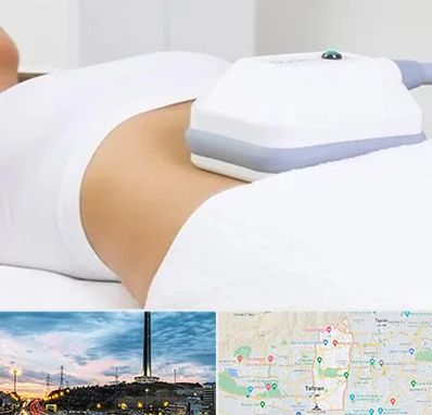 لاغری موضعی در منطقه 2 تهران 