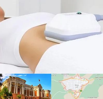 لاغری موضعی در خوی