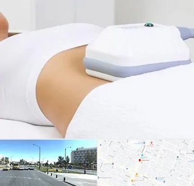 لاغری موضعی در بلوار کلاهدوز مشهد 