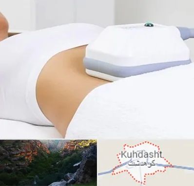 لاغری موضعی در کوهدشت