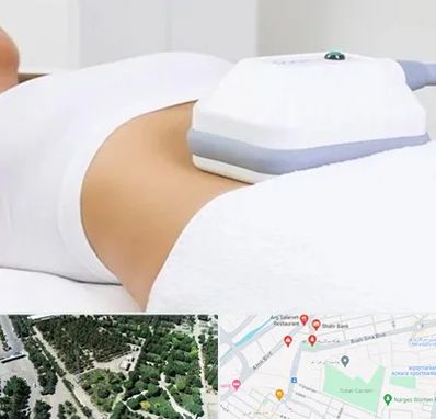 لاغری موضعی در سالاریه قم