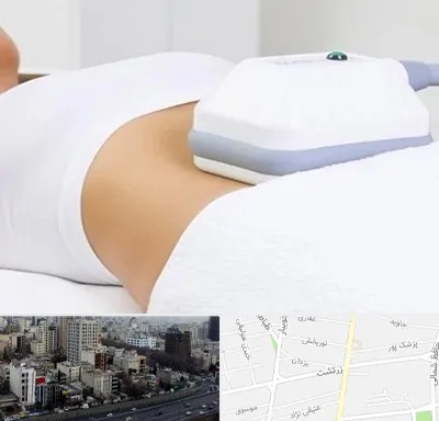 لاغری موضعی در زرتشت