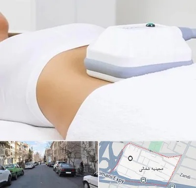 لاغری موضعی در مجیدیه شمالی