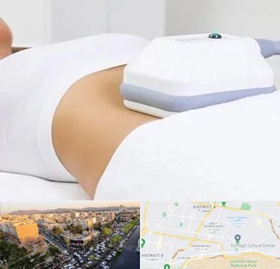 لاغری موضعی در تهرانپارس 