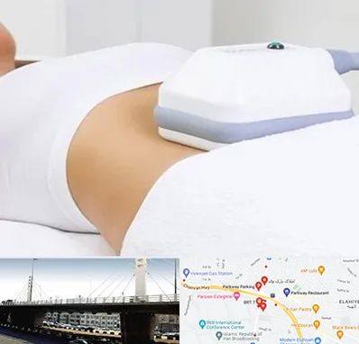 لاغری موضعی در پارک وی 