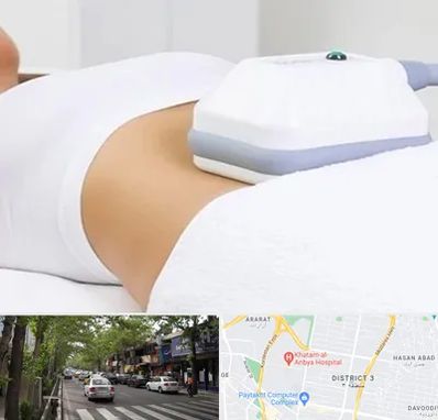 لاغری موضعی در ظفر 