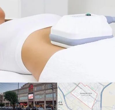 لاغری موضعی در قائمیه اسلامشهر