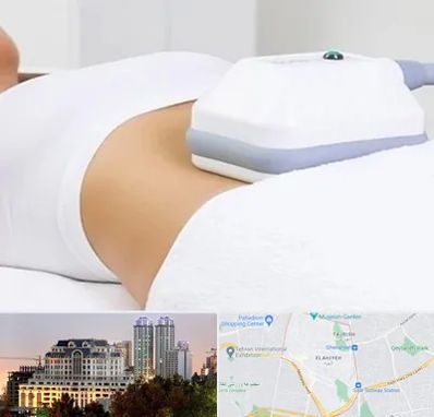 لاغری موضعی در فرشته 