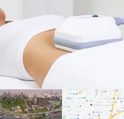 لاغری موضعی در آیت الله کاشانی