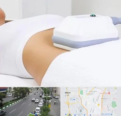 لاغری موضعی در ستارخان 