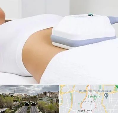 لاغری موضعی در یوسف آباد 