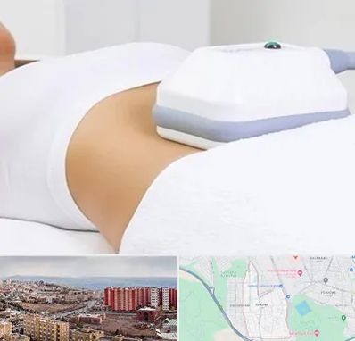 لاغری موضعی در سهند تبریز