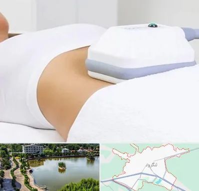 لاغری موضعی در لنگرود