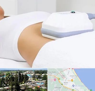 لاغری موضعی در رودسر