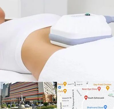 لاغری موضعی در سهروردی 