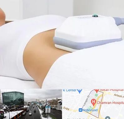 لاغری موضعی در اقدسیه 