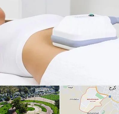 لاغری موضعی در مهرشهر کرج 